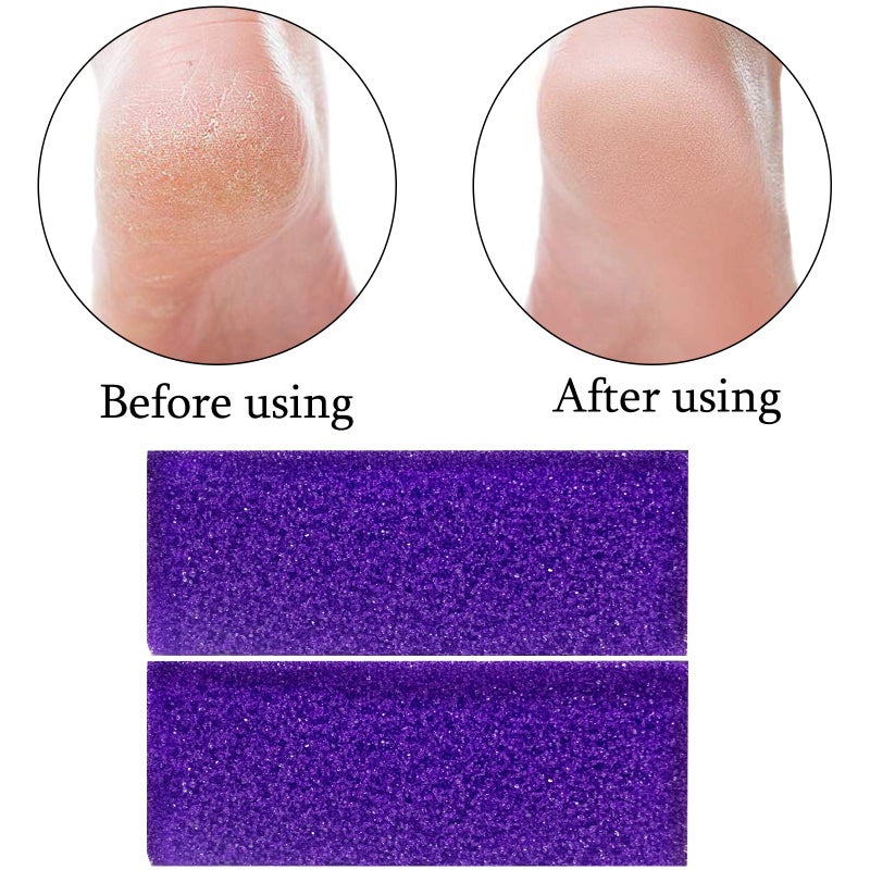 Tailpa 40 Pcs Pumice Stone for Feet Foot Scrubber Sponge for Feet Care and Callus Remover Mini Disposable Pumice Pads for Dead Skin Remover (Purple) - Image 2